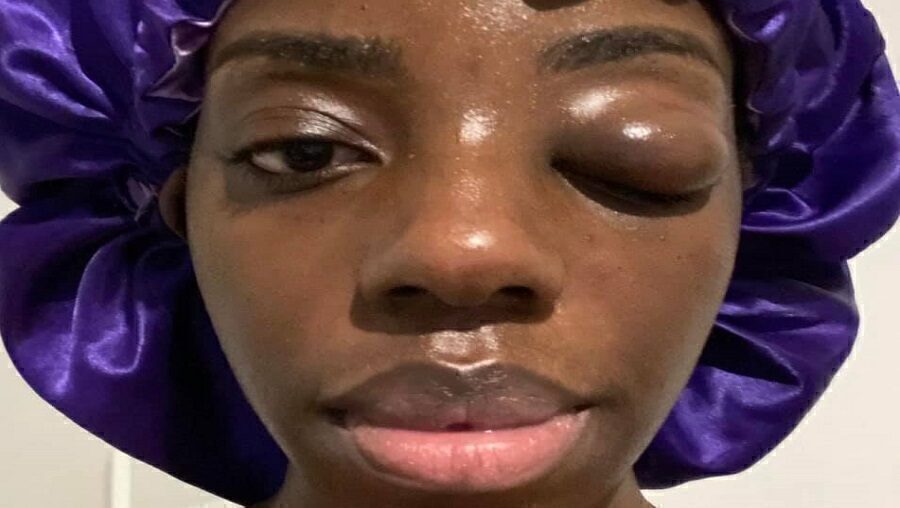 Jeny Bsg: la danseuse congolaise victime de violences conjugales rompt avec son fiancé